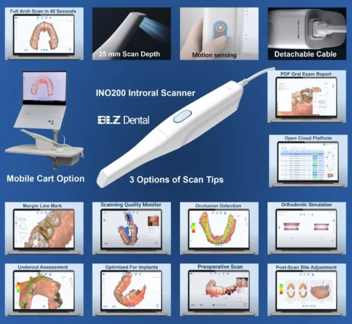 Intraoral Digital Scanner IN200